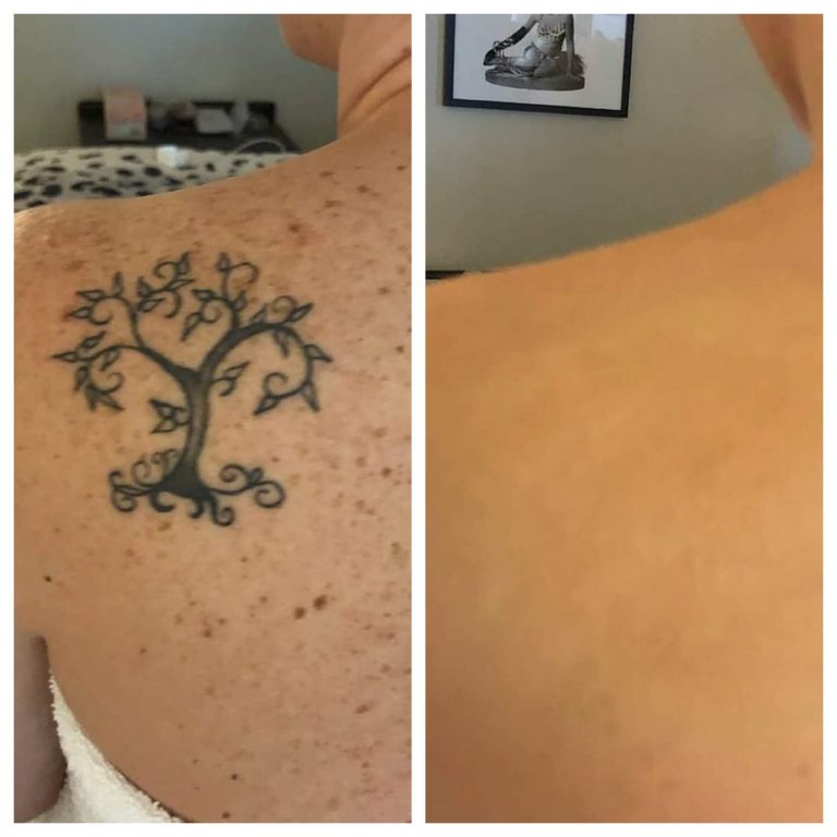 Las Vegas tattoo makeup cover up