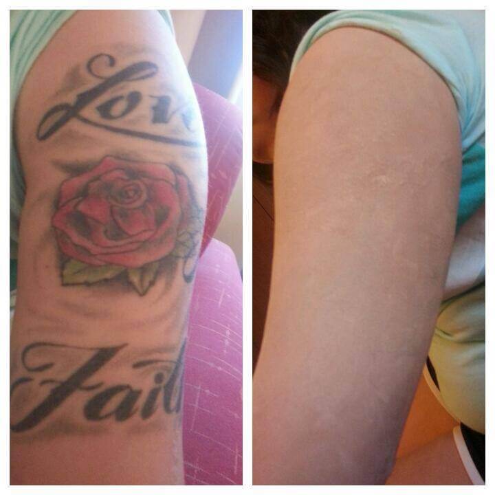 Tattoo cover up Las Vegas