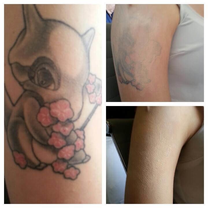 Tattoo-cover-up-for-wedding-Las-Vegas-1